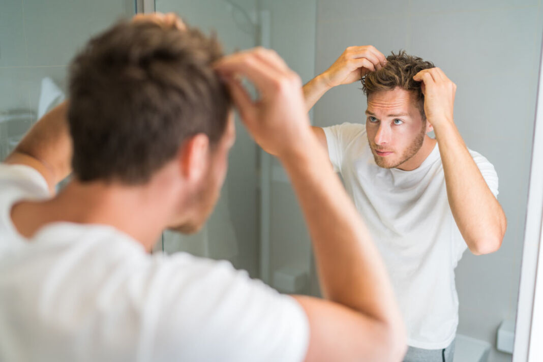 Alopecia Androgenetica, Sintomi E Soluzioni Per La Perdita Dei Capelli