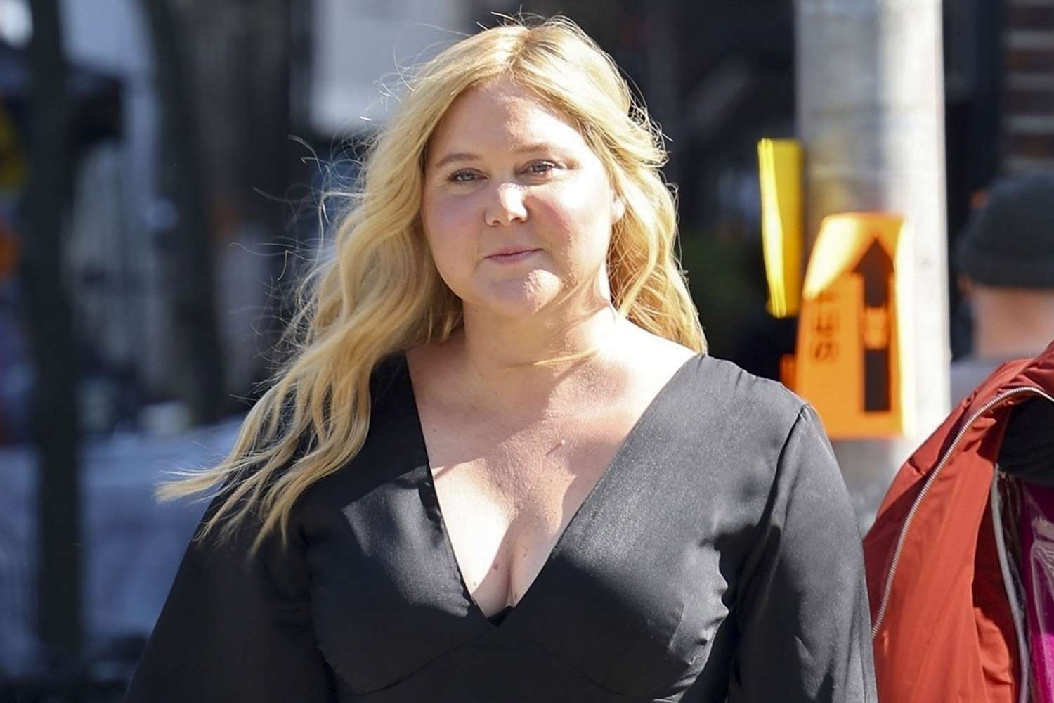 Amy Schumer Ho La Sindrome Di Cushing Cosè