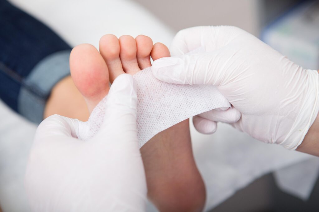 Quali sono i primi sintomi del piede diabetico?